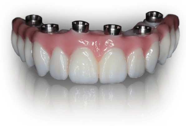 acrylic zirconia full arch bridge comparison teeth #25670