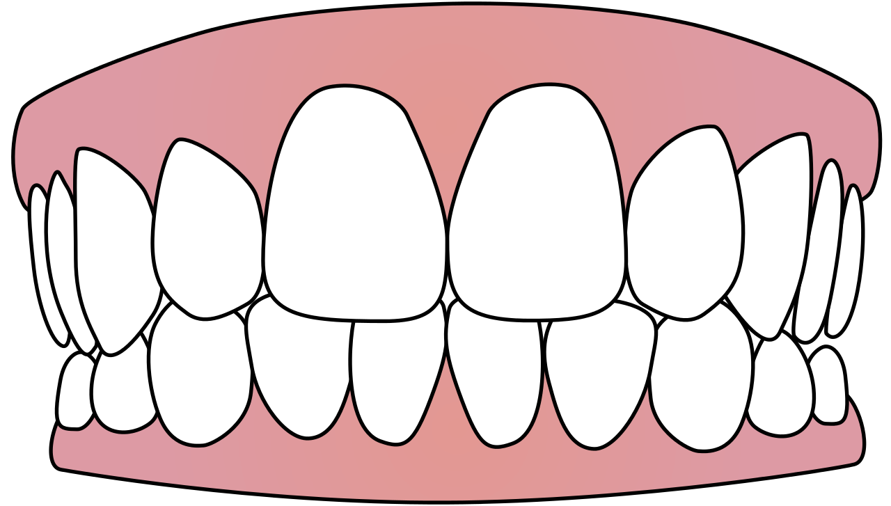 teeth mouth, tooth transparent icon download #25707