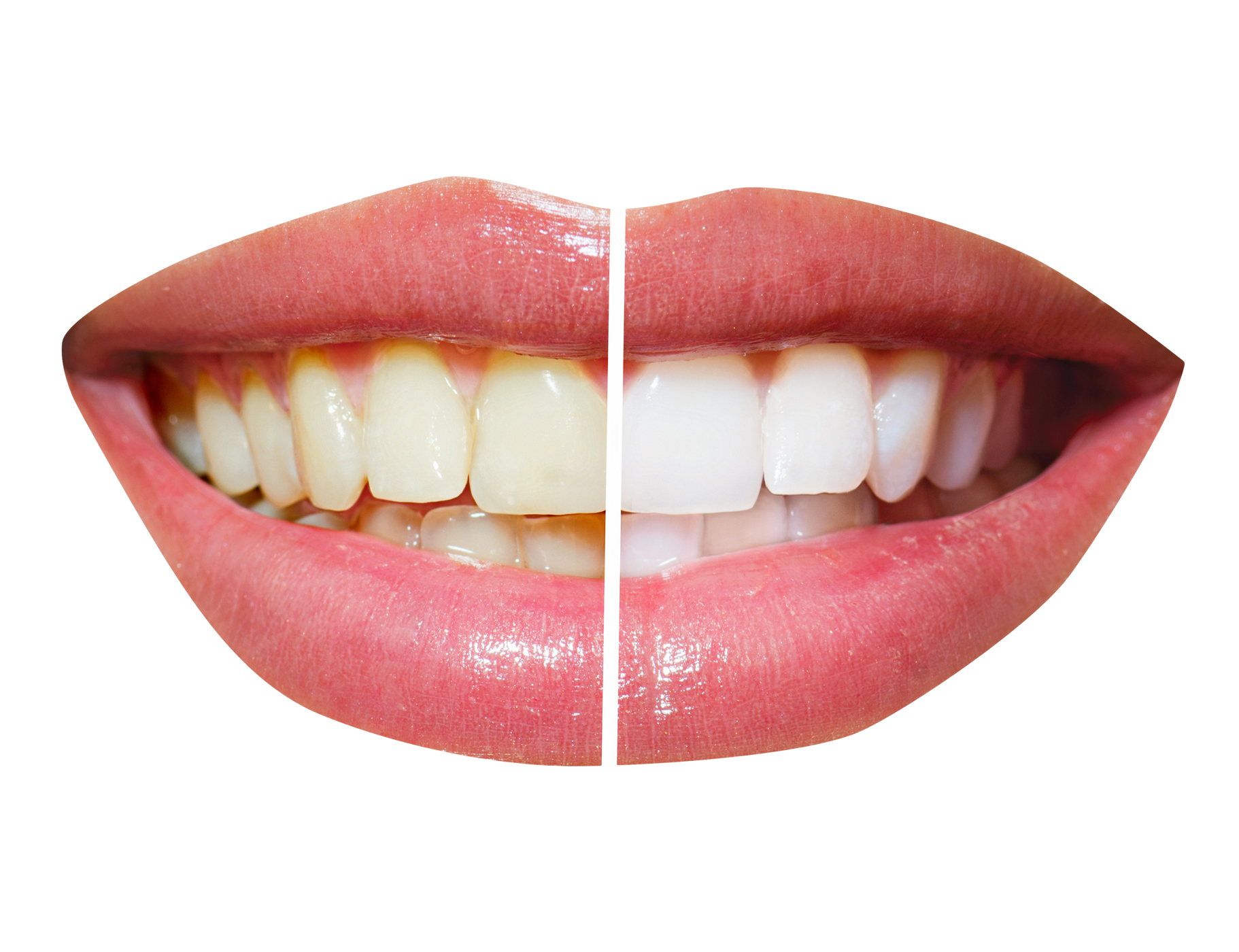 Teeth Png Single Teeth Clipart Free Download Free Transparent Png Logos