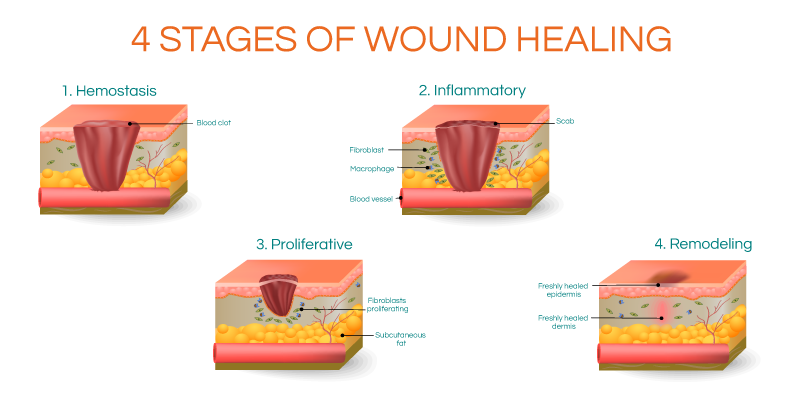 can exercise speed wound healing newgel for scars #30189